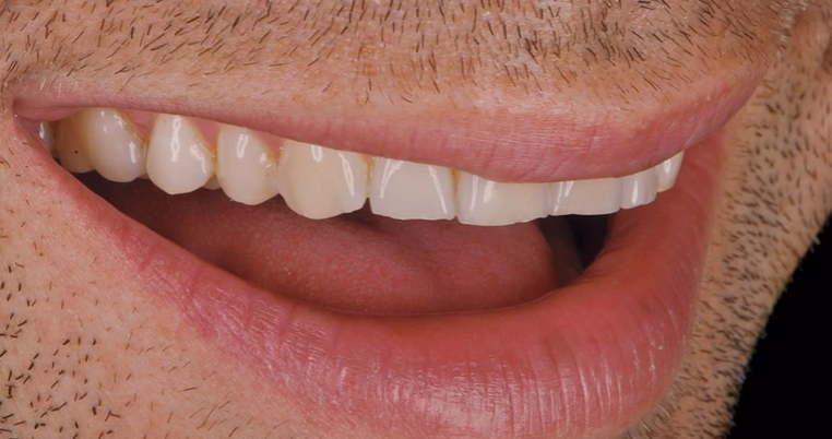 Caso clínico 10 - Antes