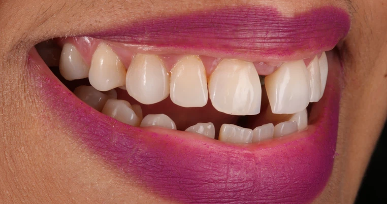 Caso clínico 8 - Antes