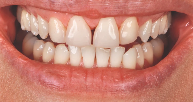 Caso clínico 9 - Antes