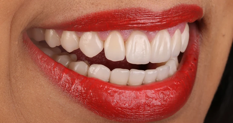 Caso clínico 8 - Después