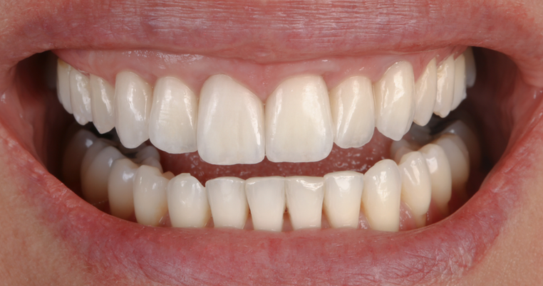 Caso clínico 9 - Después